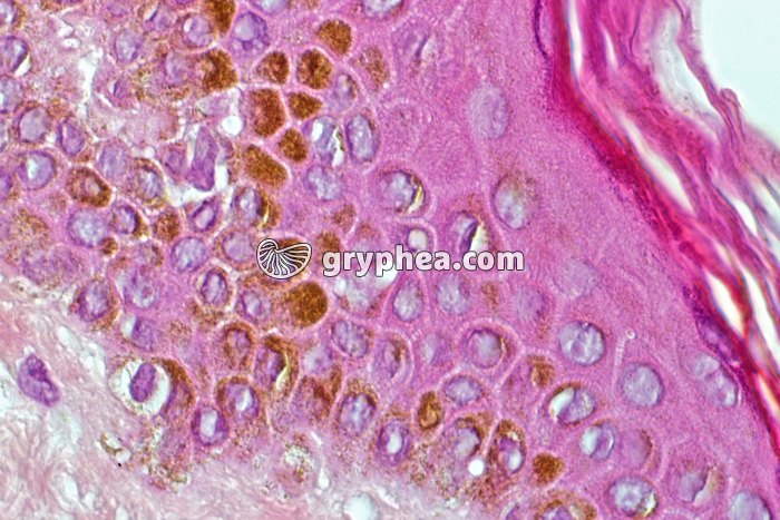 Peau race noire avec  mélanocytes CT x200 - gryphea.org